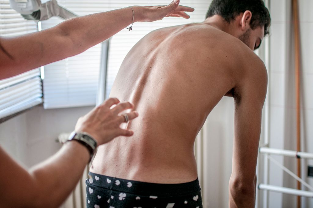 patient recommended for Epidural Injections